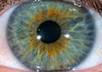 give you an iridology reading with written information about your eyes health patterns small2