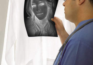 send you a picture of doctor holding your xray film big2