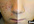 remove your pimples from 10 photos on PROFESSIONAL
