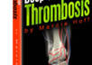give you a complete guide to deep vein thrombosis