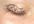 put message on my eyelid or under my eye