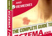 give you a complete guide on eczema and psoriasis