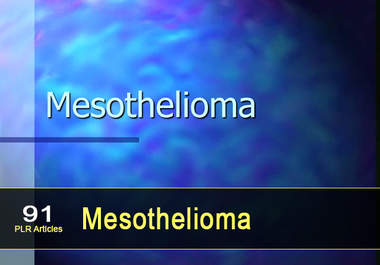 give you 91 PLR Articles on Mesothelioma big1