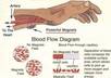 give you 20 high quality articles with private label rights about magnet therapy treatment for chronic pain arthritis stress pain relief etc