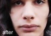 get rid of any skin imperfections on your photo small1