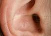 tell you how to treat severe ear pain with a simple remerdy you can get small1